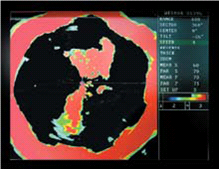 WESMAR SS395  ULTIMATE GAMEFISHING SONAR